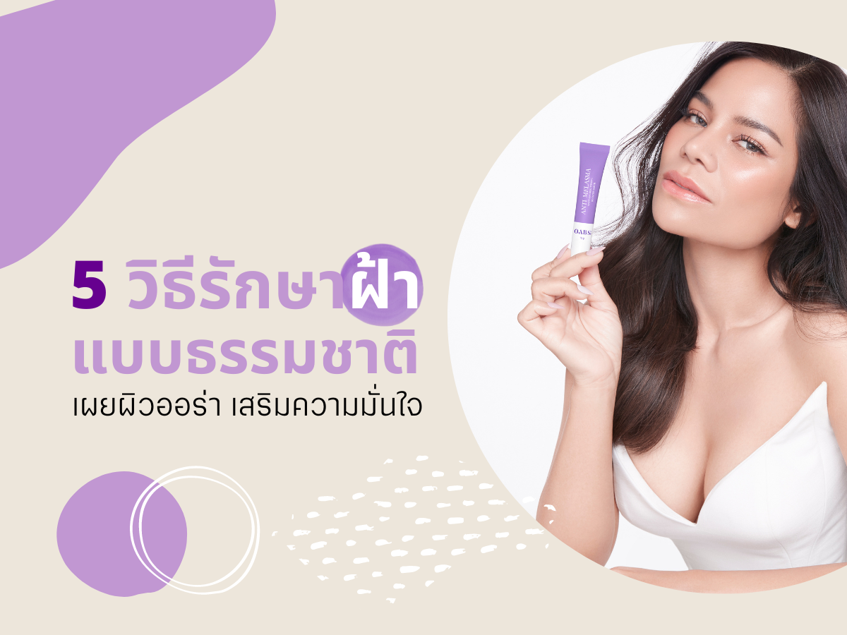 5 วิธีรักษาฝ้าแบบธรรมชาติ เผยผิวออร่า เสริมความมั่นใจ